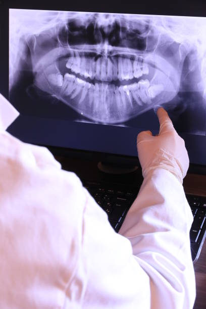 Best Emergency Dental Care for Sports Injuries in Sulphur Springs, TX